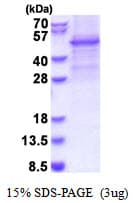 Human GSK3B / GSK3 Beta Protein (Recombinant His)