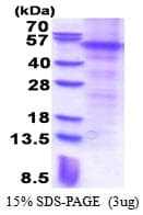 Human PARK2 / Parkin 2 Protein (Recombinant His)