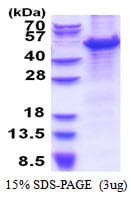 Human MCM7 Protein (Recombinant His)
