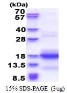 Human CNPY1 Protein (Recombinant His)