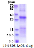 Human TGFBRAP1 / TRAP-1 Protein (Recombinant His)