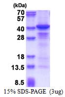 Human CSNK1A1 / CK1 Alpha Protein (Recombinant His)