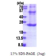 Human PROCR / EPCR Protein (Recombinant His)