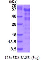 Human STK11 / LKB1 Protein (Recombinant His)