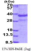 Human AZGP1 / ZAG Protein (Recombinant His)