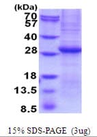 Human GZMB / Granzyme B Protein (Recombinant His)