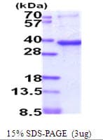 Human IGFBP3 Protein (Recombinant His)