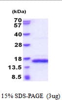 Human PDGF-BB Protein (Recombinant His)