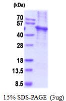Human KLF4 Protein (Recombinant His)