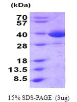 Human MIF Protein (Recombinant)