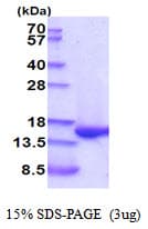 Rat FABP1 / L-FABP Protein (Recombinant His)