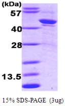 Human SERPINA1 / Alpha 1 Antitrypsin Protein (Recombinant)