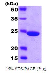E. coli Carbonic Anhydrase Protein (Recombinant His)