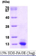 Human CCL2 / MCP1 Protein (Recombinant His)