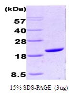 Human PPIA / Cyclophilin A Protein (Recombinant His)