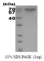 Human HSPA1A Protein (Recombinant His)