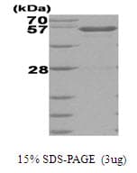 Human GCK / Glucokinase Protein (Recombinant His)