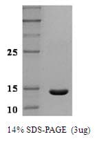 Human Leptin Protein (Recombinant)