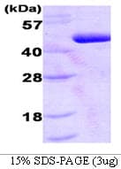 Human PDK1 Protein (Recombinant His)