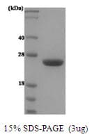 Human PRL / Prolactin Protein (Recombinant)