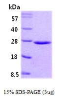Human RAB5A / RAB5 Protein (Recombinant)