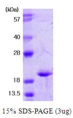 Human SOD1 / Cu-Zn SOD Protein (Recombinant)