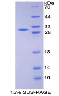 Human SRF / Serum Response Factor Protein (Recombinant His-T7)