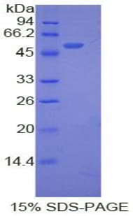 Human ANGPTL3 Protein (Recombinant His)