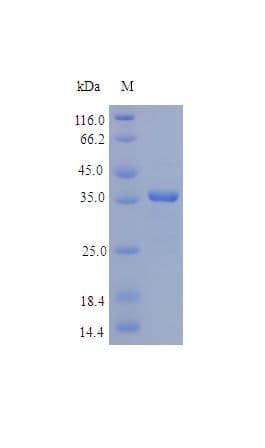 Human Osteonectin / SPARC Protein (Recombinant His)