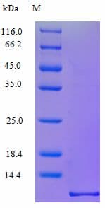 Human CCL3 / MIP-1-Alpha Protein (Recombinant)