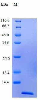 Human CCL11 / Eotaxin Protein (Recombinant)