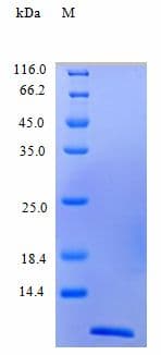 Human CCL22 / MDC Protein (Recombinant)
