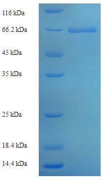 Human CASP2 / Caspase 2 Protein (Recombinant His-SUMO)