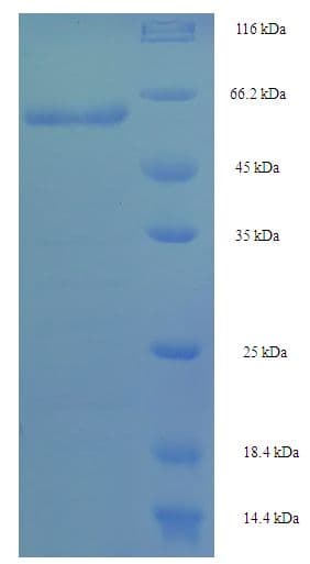 Mouse ICSBP / IRF8 Protein (Recombinant His-SUMO)