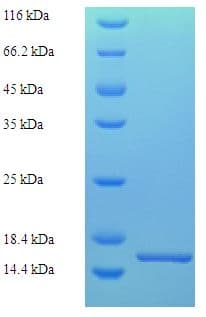 Bovine LHB / Luteinizing Hormone Protein (Recombinant 6His, N-terminus)