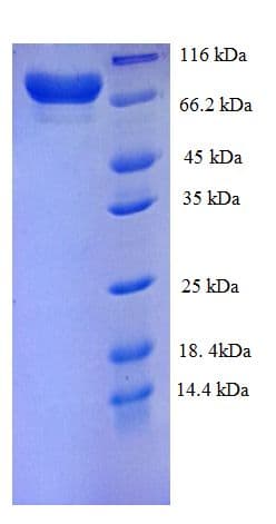 Human MMP14 Protein (Recombinant His-SUMO)