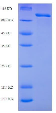 Human Mannose Receptor / CD206 Protein (Recombinant His-SUMO)