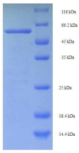 Human MSH6 Protein (Recombinant His-SUMO)
