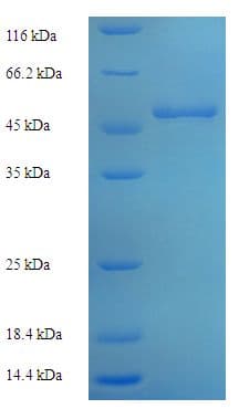 Human OTC Protein (Recombinant His-SUMO)