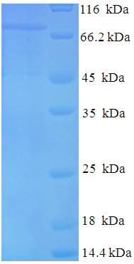Influenza A Virus Nucleoprotein (Recombinant His-SUMO)