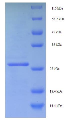 Human MYCBP Protein (Recombinant His-SUMO)
