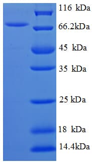 E. coli speA Protein (Recombinant His)