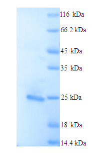 Human BCL2L11 / BIM Protein (Recombinant His)