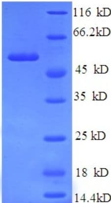 Human ICA69 / ICA1 Protein (Recombinant His)