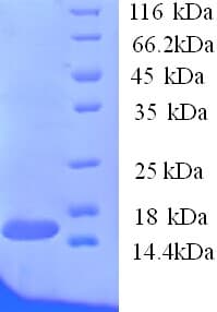 Human TANK Protein (Recombinant His)