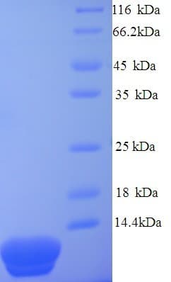 Sulfolobus solfataricus DNA-Binding Protein 7d (Recombinant His)