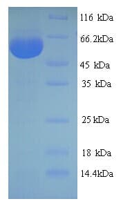 Influenza A Virus Nucleoprotein (Recombinant His)