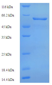 Human COL6A6 Protein (Recombinant His)