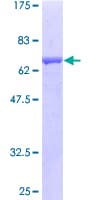 Human AOC1 Protein (Recombinant GST)