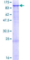 Human AOC1 Protein (Recombinant GST)